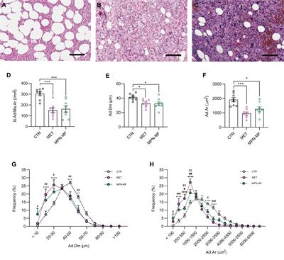 Morphological and Immunophenotypical Changes of Human Bone Marrow Adipocytes in Marrow Metastasis and Myelofibrosis